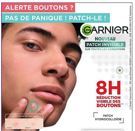 PATCH INVISIBLE SUR TOUTES LES CARNATIONS